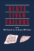 Acute Liver Failure