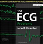 150 ECG Problems