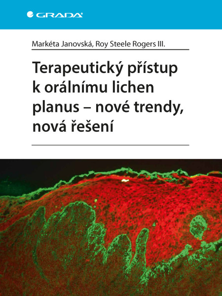 Terapeutický přístup k orálnímu lichen planus - nové trendy, nová řešení