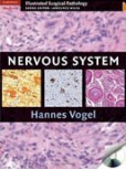 Nervous System